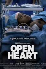 Open Heart